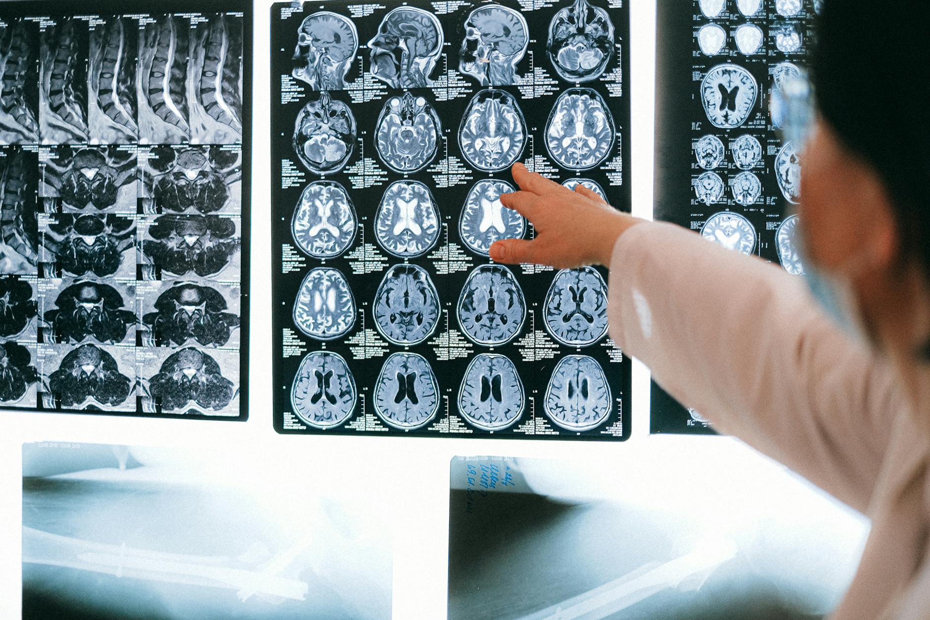 Neuroplasticite et tryptamines : nouvelles perspectives