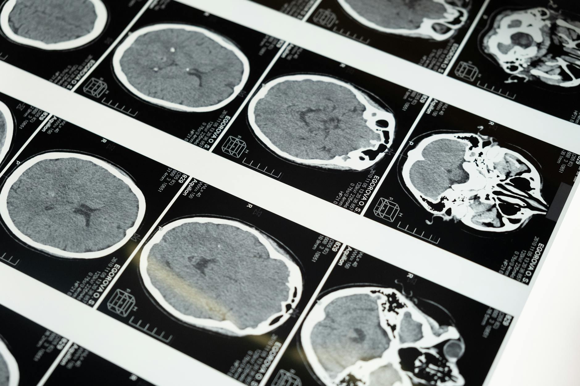 Default Mode Network e triptamine: Influenza